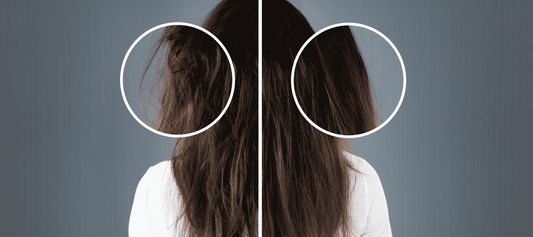 Healthy Hair Starts from Within: Nutrition and Lifestyle Tips for Stronger, Shinier Hair